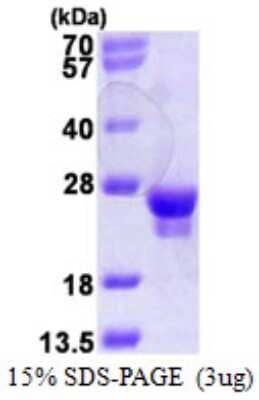 SDS-PAGE: Recombinant Human RAB18 T7 Protein [NBP1-72528]