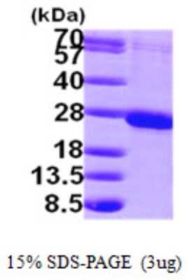 SDS-PAGE: Recombinant Human RAB1B His Protein [NBP1-50912]