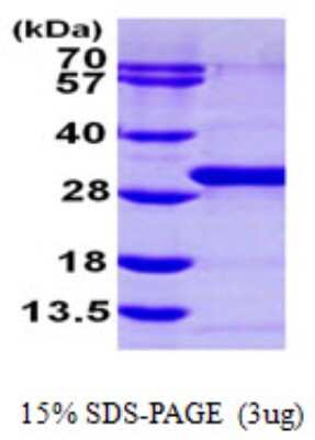 SDS-PAGE: Recombinant Human RAB21 His Protein [NBP1-50986]