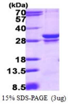 SDS-PAGE: Recombinant Human RAB23 His Protein [NBP1-72529]