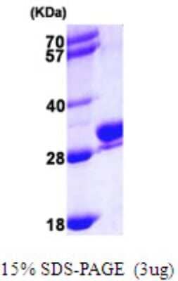 SDS-PAGE: Recombinant Human RAB27B His Protein [NBP1-50947]