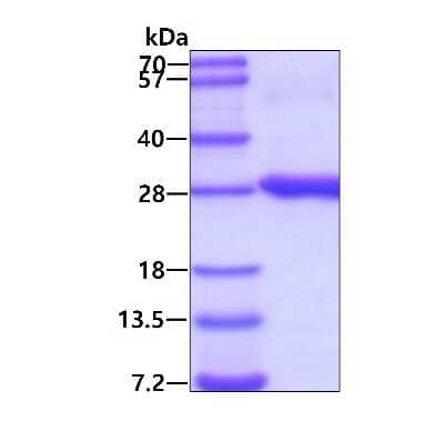 SDS-PAGE: Recombinant Human RAB2B His Protein [NBP1-78858]