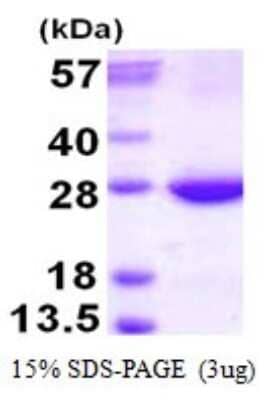 SDS-PAGE: Recombinant Human RAB31 His Protein [NBP1-99009]