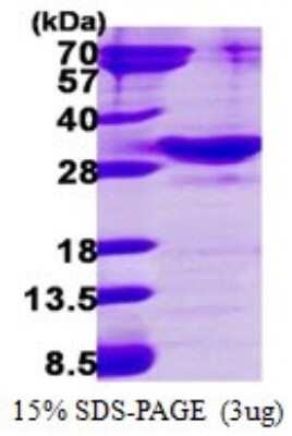 SDS-PAGE: Recombinant Human RAB34 His Protein [NBP1-72530]