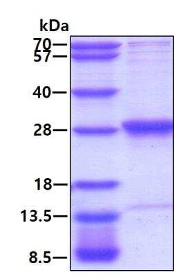 SDS-PAGE: Recombinant Human RAB3B His Protein [NBP1-72357]