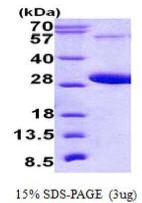 SDS-PAGE: Recombinant Human RAB5C His Protein [NBP2-23393]