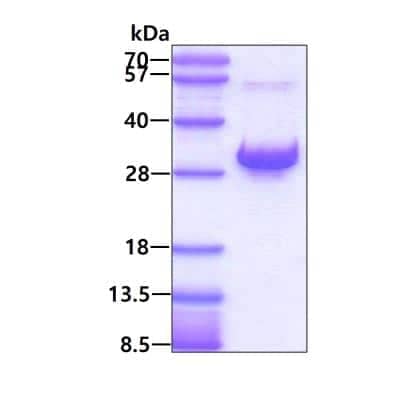 SDS-PAGE: Recombinant Human RAB6A His Protein [NBP1-50915]