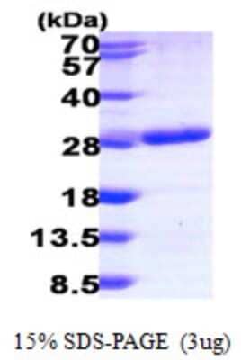 SDS-PAGE: Recombinant Human RAB6B His Protein [NBP1-50995]