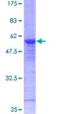 SDS-PAGE: Recombinant Human RAB8A GST (N-Term) Protein [H00004218-P01]