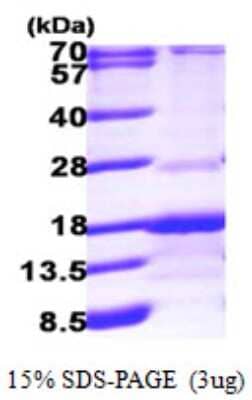 SDS-PAGE: Recombinant Human RABIF/MSS4 His Protein [NBP1-48342]