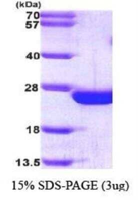 SDS-PAGE: Recombinant Human RAC2 His Protein [NBP1-30199]