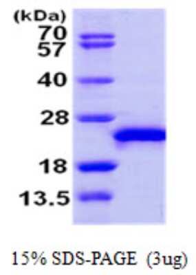 SDS-PAGE: Recombinant Human RAC3 Protein [NBP1-50927]