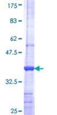 SDS-PAGE: Recombinant Human MOK GST (N-Term) Protein [H00005891-Q01]