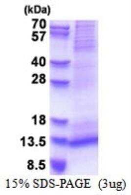 SDS-PAGE: Recombinant Human RAMP1 His Protein [NBP2-51534]