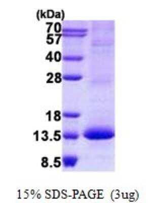 SDS-PAGE: Recombinant Human RAMP3 His Protein [NBP2-23402]