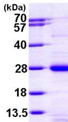 SDS-PAGE: Recombinant Human RAP1A His Protein [NBP1-45263]