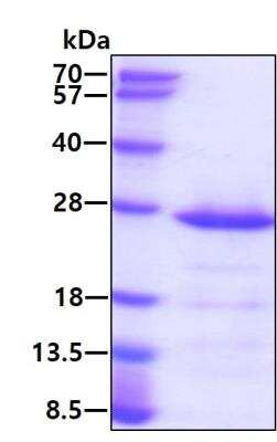 SDS-PAGE: Recombinant Human RAP1B His Protein [NBP1-50971]