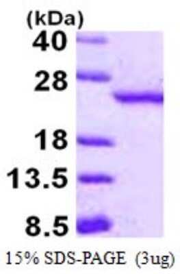 SDS-PAGE: Recombinant Human RBBP9 His Protein [NBP1-72549]