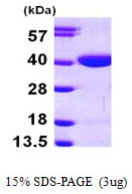 SDS-PAGE: Recombinant Human RBKS His Protein [NBP1-50911]