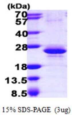 SDS-PAGE: Recombinant Human RBM8A His Protein [NBP1-51060]