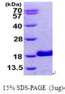 SDS-PAGE: Recombinant Human RBP5 His Protein [NBP1-49310]