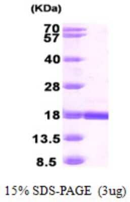 SDS-PAGE: Recombinant Human RBP7 His Protein [NBP1-51011]