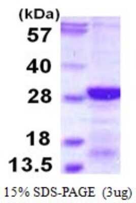 SDS-PAGE: Recombinant Human RCAN2 His Protein [NBP1-72547]