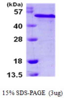 SDS-PAGE: Recombinant Human RCN2 His Protein [NBP1-51066]