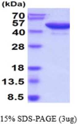 SDS-PAGE: Recombinant Human RCN3 His Protein [NBP1-99085]