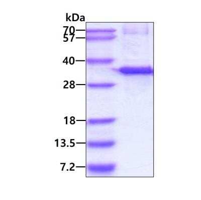 SDS-PAGE: Recombinant Human RDH12 His Protein [NBP1-78870]