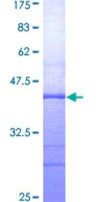 SDS-PAGE: Recombinant Human RED1 GST (N-Term) Protein [H00000104-Q01]