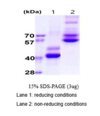 SDS-PAGE: Recombinant Human RELT/TNFRSF19L hIgG-His Protein [NBP2-77513]