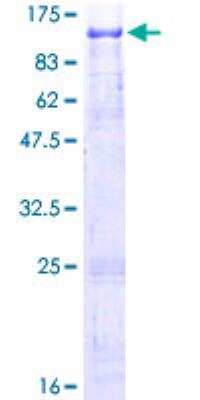 SDS-PAGE: Recombinant Human REPS1 GST (N-Term) Protein [H00085021-P01]