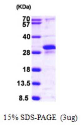 SDS-PAGE: Recombinant Human RERG His Protein [NBP1-50998]