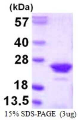 SDS-PAGE: Recombinant Human RGS10 His Protein [NBP1-72389]