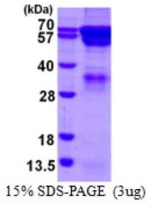 SDS-PAGE: Recombinant Human RGS14 His Protein [NBP1-98906]