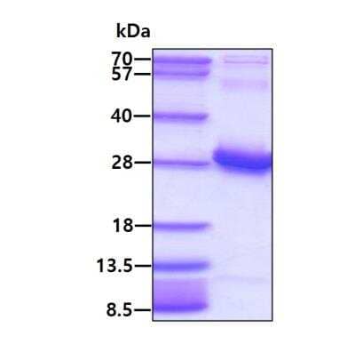 SDS-PAGE: Recombinant Human RGS16 His Protein [NBP1-41226]