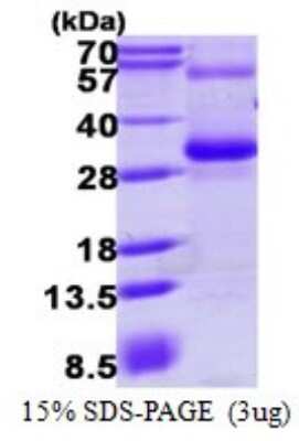 SDS-PAGE: Recombinant Human RGS17 His Protein [NBP1-72443]