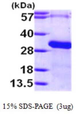 SDS-PAGE: Recombinant Human RGS19 His Protein [NBP1-50894]