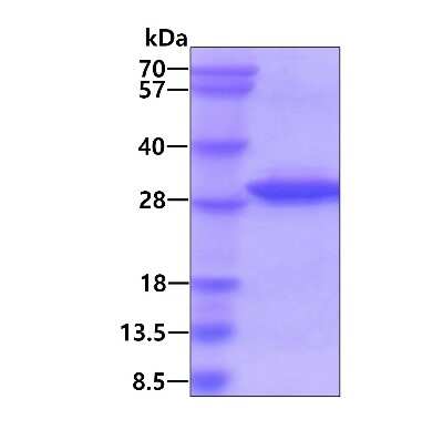 SDS-PAGE: Recombinant Human RGS2 His Protein [NBP1-51045]