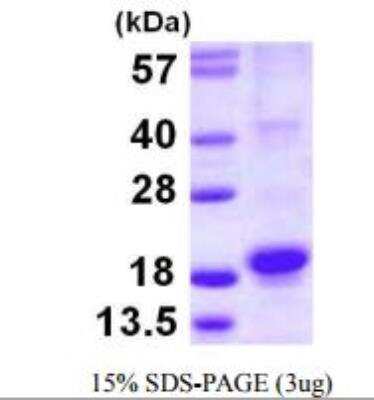 SDS-PAGE: Recombinant Human RGS21 His Protein [NBP1-78808]