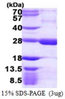 SDS-PAGE: Recombinant Human RGS5 His Protein [NBP1-72414]