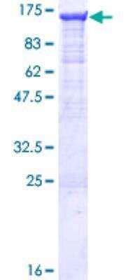 SDS-PAGE: Recombinant Human RIG-I GST (N-Term) Protein [H00023586-P01]