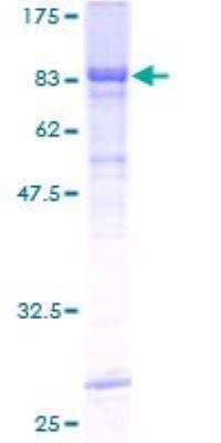 SDS-PAGE: Recombinant Human RIPK3/RIP3 GST (N-Term) Protein [H00011035-P01]