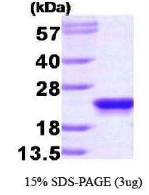 SDS-PAGE: Recombinant Human RKIP/PBP Protein [NBP1-30224]