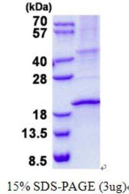 SDS-PAGE: Recombinant Human RNASE3 His Protein [NBP2-23415]