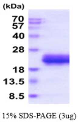 SDS-PAGE: Recombinant Human RNASE3 His Protein [NBP2-59509]