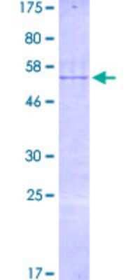 SDS-PAGE: Recombinant Human RNPC3 GST (N-Term) Protein [H00055599-P01]