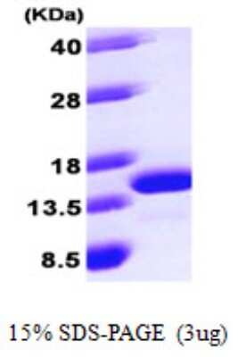 SDS-PAGE: Recombinant Human ROBLD3 His Protein [NBP1-50918]