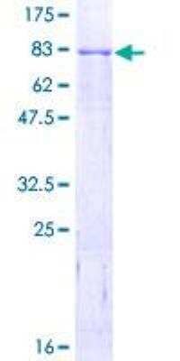 SDS-PAGE: Recombinant Human ROR alpha/NR1F1 GST (N-Term) Protein [H00006095-P01]